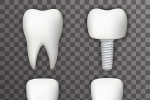 Gerçekçi 3D implat maketleri